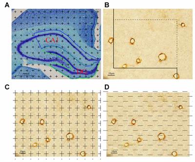 Stereological Study on the Positive Effect of Running Exercise on the Capillaries in the Hippocampus in a Depression Model